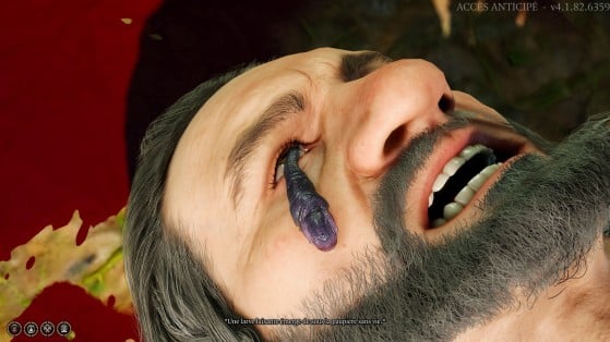 Écrasez ça ! - Baldur's Gate 3